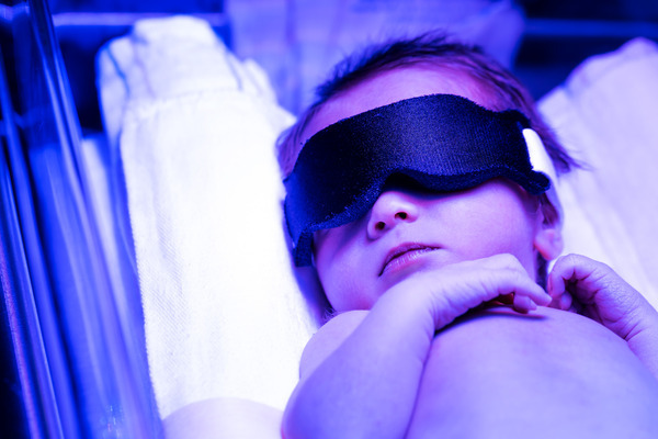 Beneficios de la fototerapia neonatal