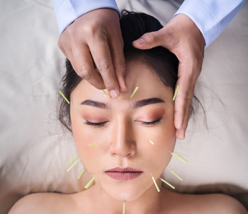 ¿Para qué sirve la acupuntura? 9 Beneficios de la acupuntura